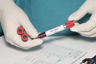 hiv test vial via Shutterstock